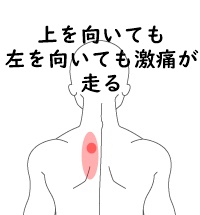 甲骨 痛み 肩 筋違いの治療法【肩甲骨･肩】